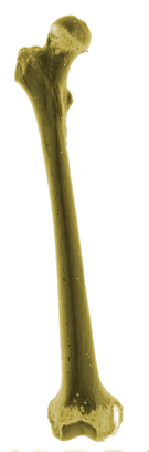 femur3D