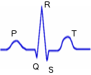 ecg